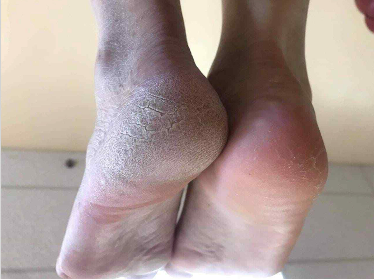 Nu Skin Epoch Sole Solution Foot Treatment