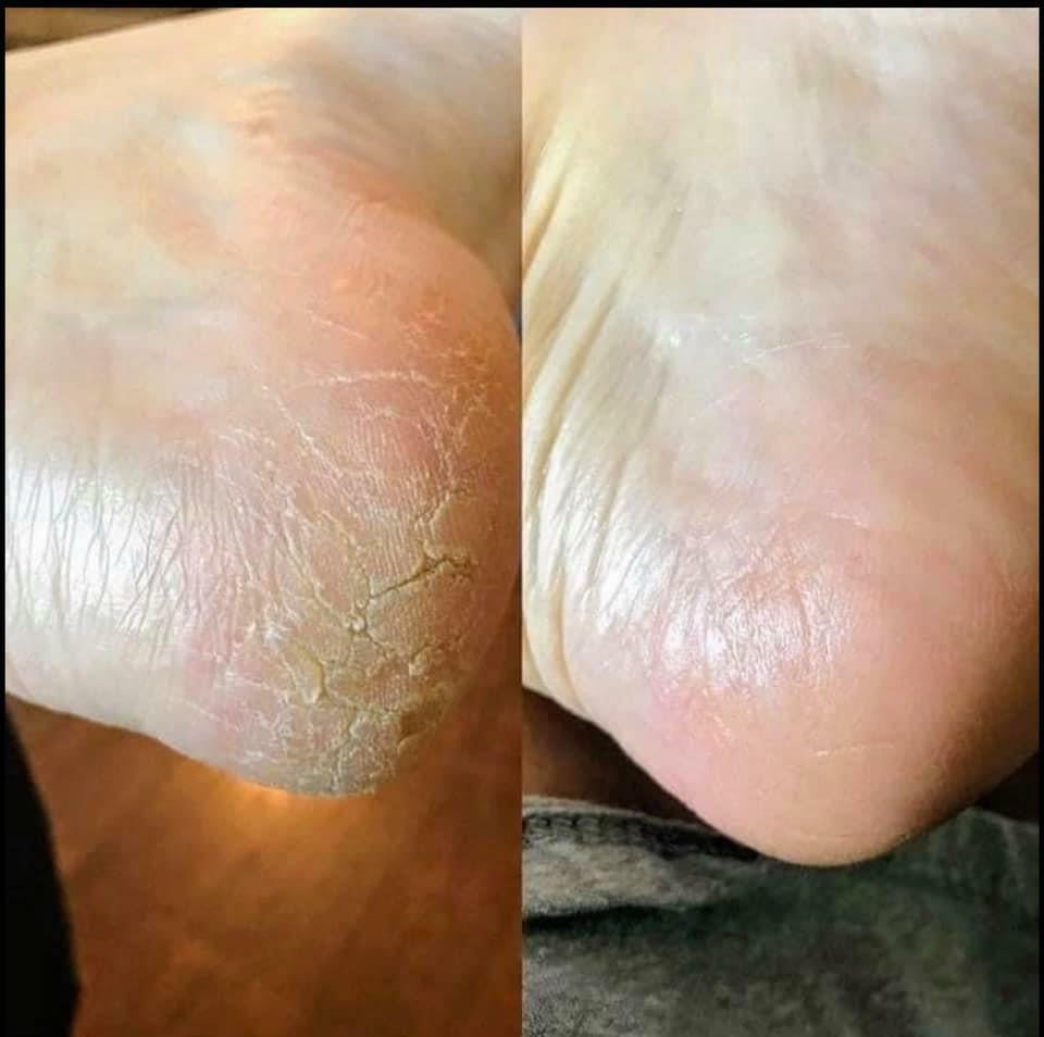 Nu Skin Epoch Sole Solution Foot Treatment
