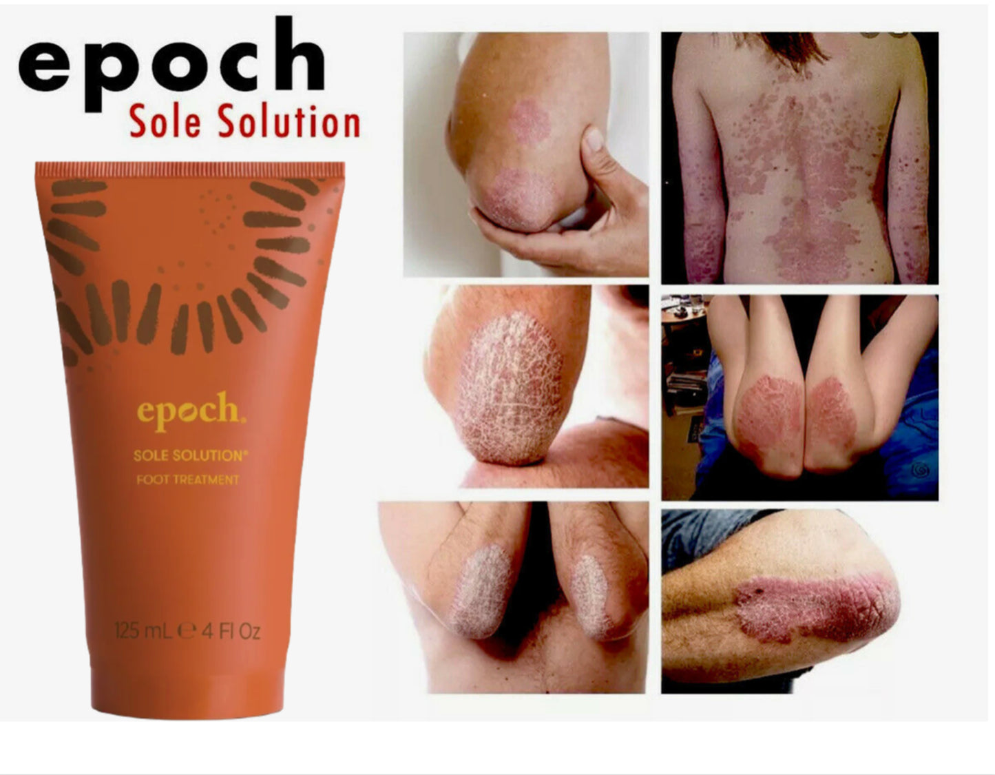 Nu Skin Epoch Sole Solution Foot Treatment