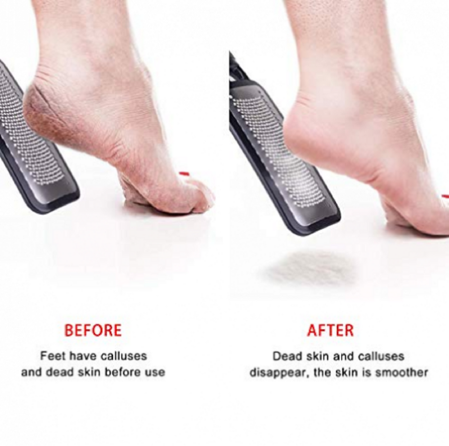 Foot Rasp Pedicure File Callus Remover