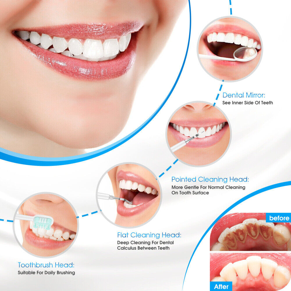 Ultrasonic Dental Scaler - Electric Tooth Cleaner