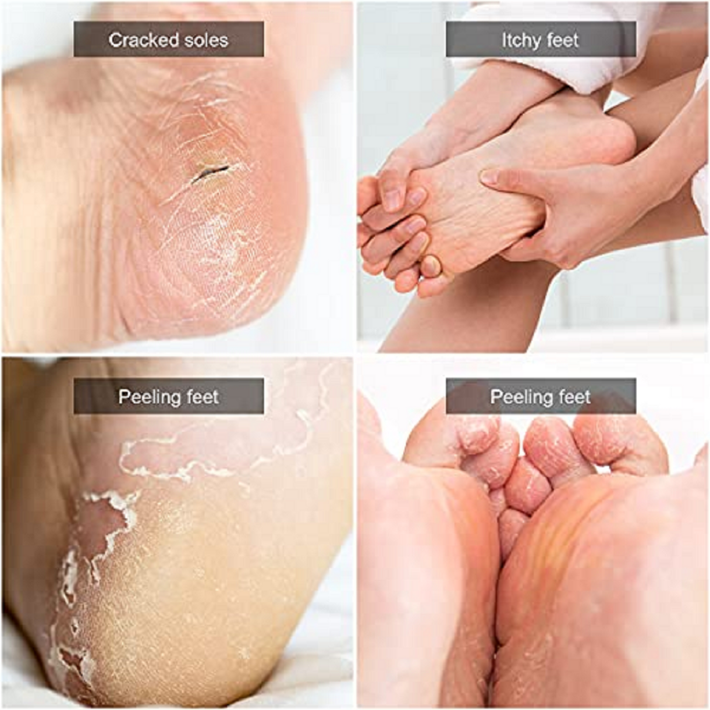 Foot Rasp Pedicure File Callus Remover