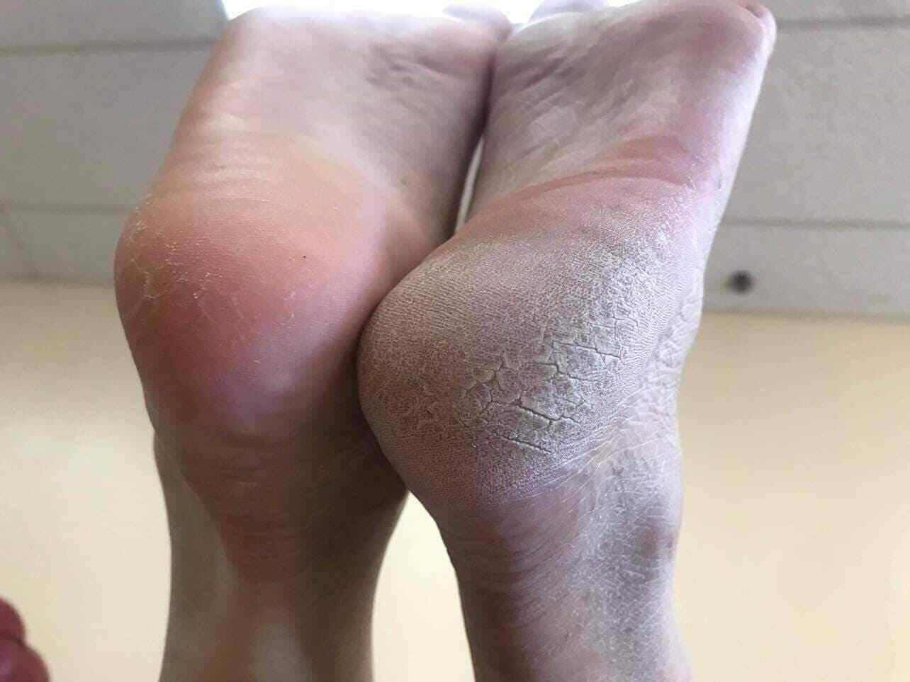 Nu Skin Epoch Sole Solution Foot Treatment