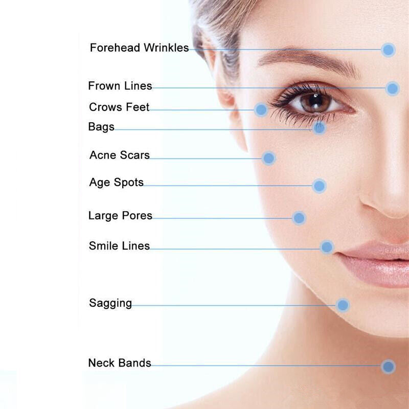 Titanium Microneedle Derma Roller