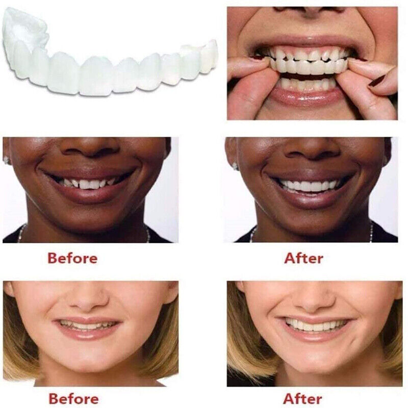 Snap On Upper & Lower False Teeth Covers