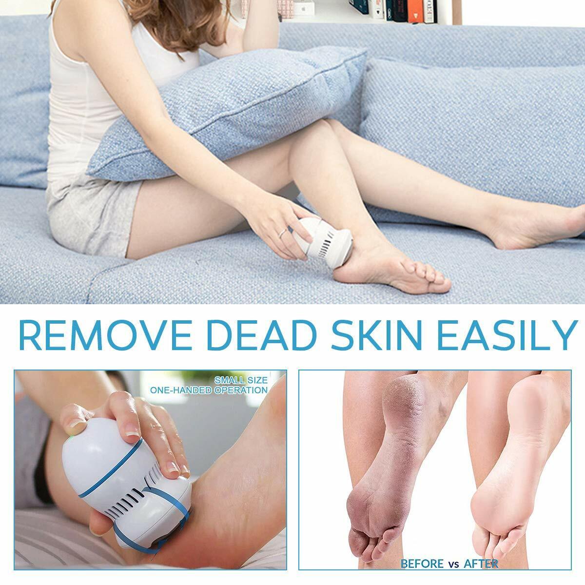 Foot Grinder Electric Vacuum - Dead Skin Remover