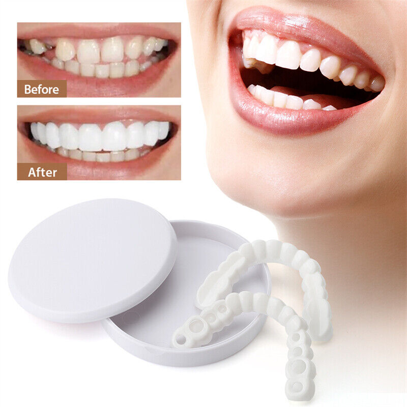 Snap On Upper & Lower False Teeth Covers