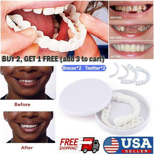 Snap On Upper & Lower False Teeth Covers