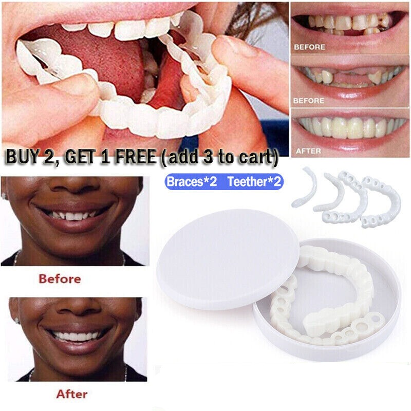 Snap On Upper & Lower False Teeth Covers
