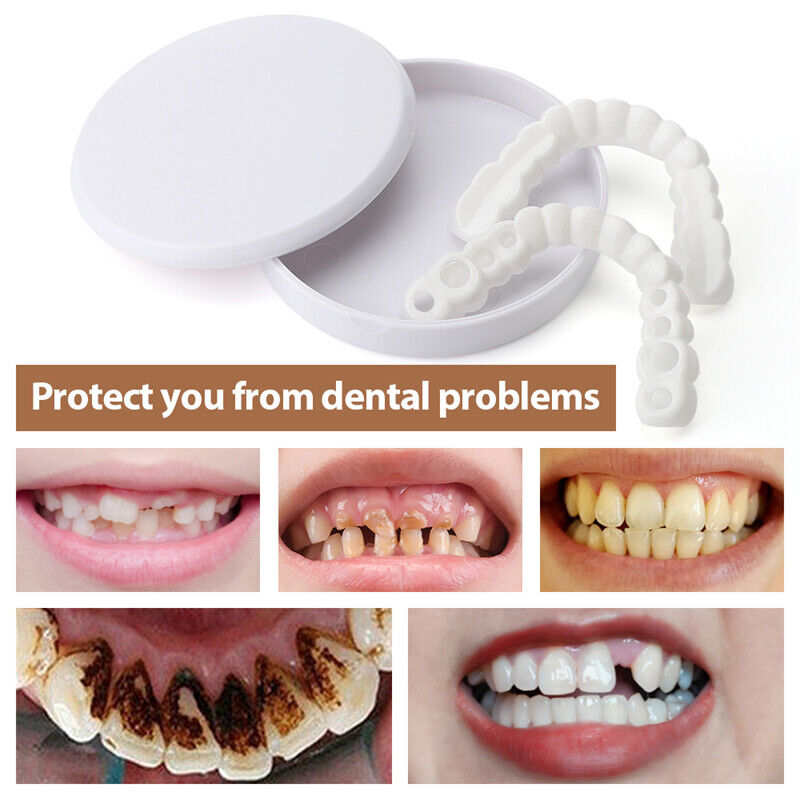 Snap On Upper & Lower False Teeth Covers